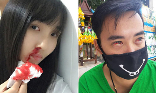 Dân Bangkok che mặt bằng đồ lót, hắt hơi ra máu vì ô nhiễm