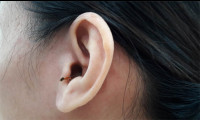 Xử lí khi côn trùng chui vào tai ai cũng nên biết